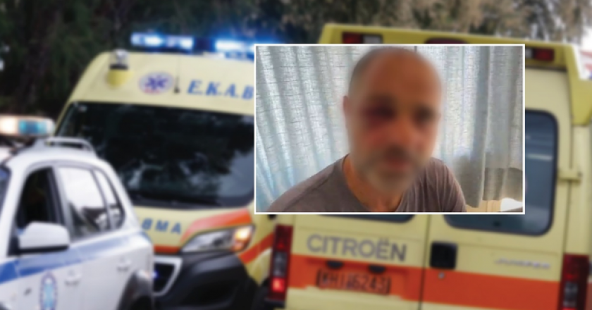 E rëndë në Kretë/ Shqiptarët babë e bir rrahin keq me bastun grekun në mes të rrugës