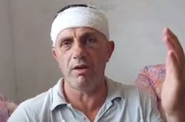 Dhuna barbare në Krujë, flet një nga të plagosurit: Më goditën me tyta armësh, s’ja falë sa të jem gjallë fisit Rraja (VIDEO)
